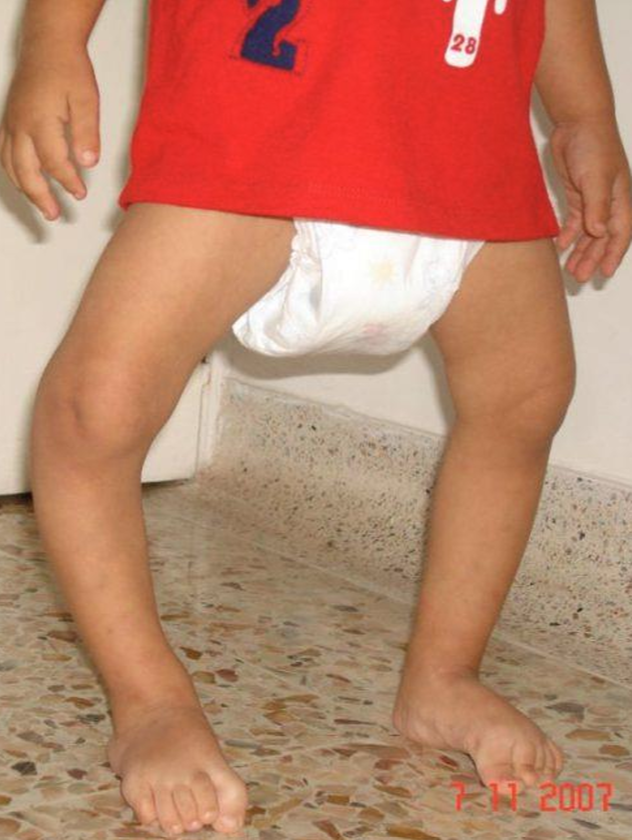 Genuvaro 2